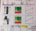 草莓视频入口仪价格重要吗？不想骨骼脆弱医生教你看懂草莓视频入口报告