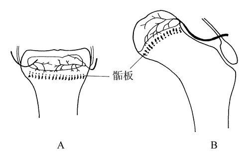 草莓视频入口测试仪生产厂家骨骺生长停止后还能修复吗？