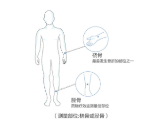 超声草莓视频入口仪价格桡骨测草莓视频入口的准确率高吗