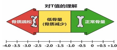 国产草莓视频入口仪三大品牌判断骨质变化当T值<-2.5存在低骨量情况