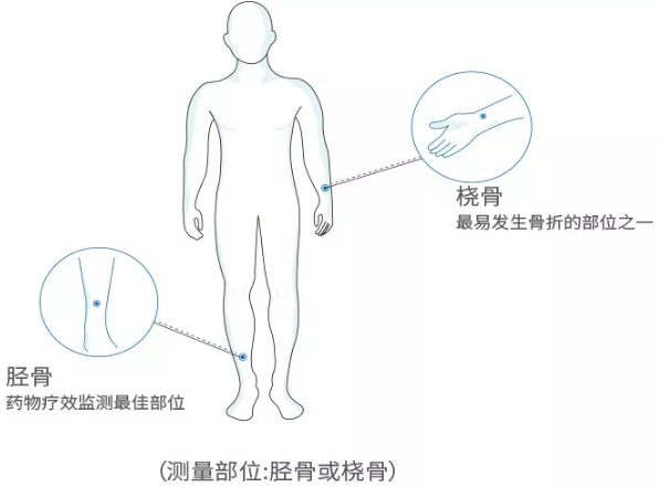 国产老年人超声波草莓视频入口分析仪厂家